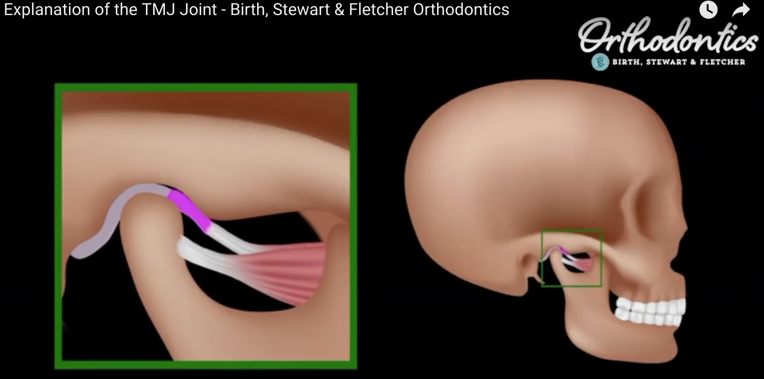 How Orthodontics With Jaw | Orthodontics Birth & Fletcher