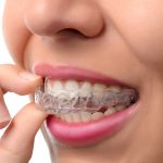 When-Start-Adult-Orthodontic-Treatment