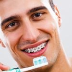 Guide To Flossing And Maintaining Oral Hygiene With Braces