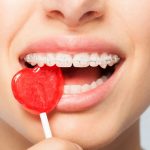 Halloween Candy to Avoid If You Have Brace